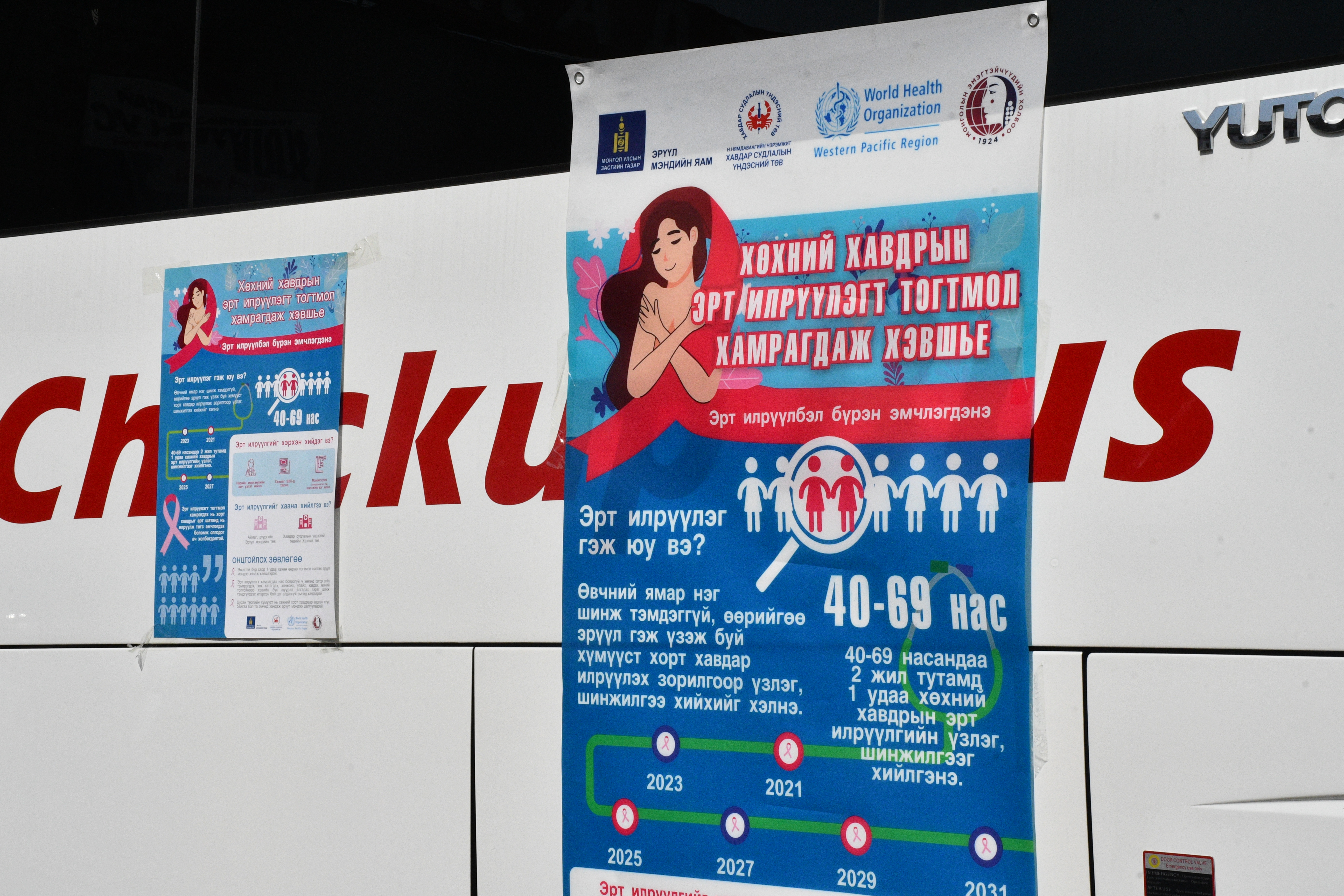 ХСҮТ-ийн автобусыг эрт илрүүлэх үзлэг, оношилгоонд нэвтрүүлж эхэллээ