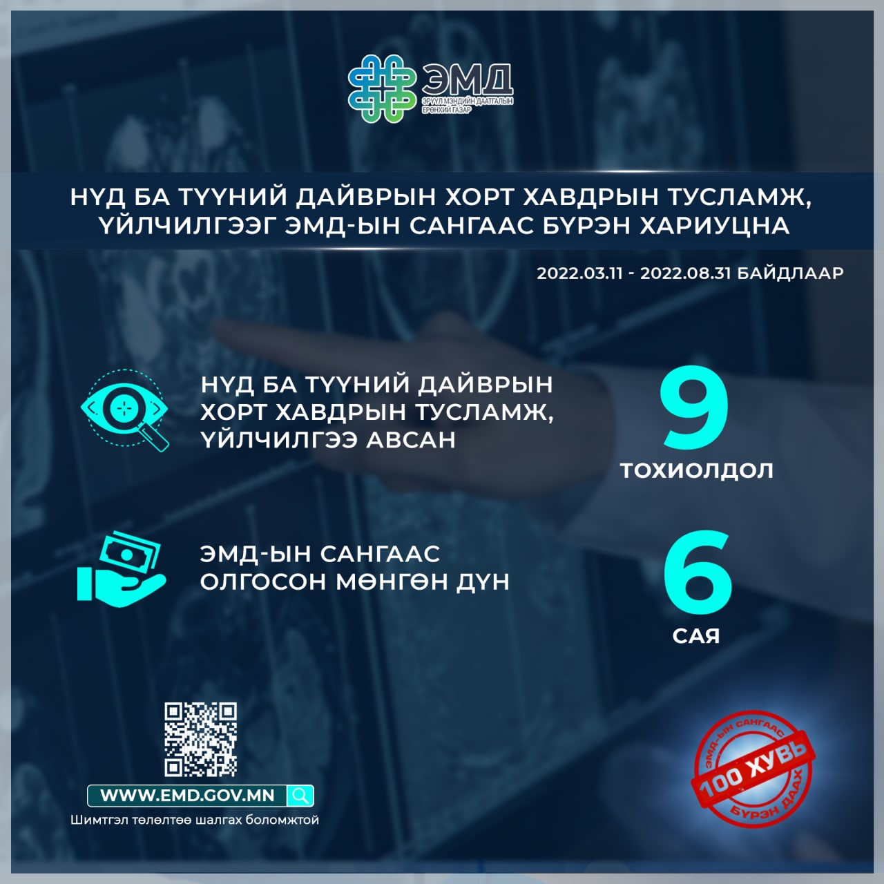 Нүд ба түүний дайврын хорт хавдрын тусламж, үйлчилгээг ЭМД-ын сангаас бүрэн хариуцна