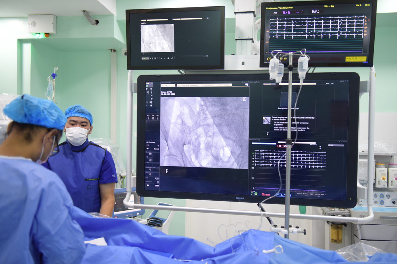 Зургаан аймаг “АНГИОГРАФИЙН АППАРАТ”-тай болсноор ИРГЭД ОРОН НУТАГТАА өндөр өртөгт эмнэлгийн тусламж үйлчилгээг авч байна