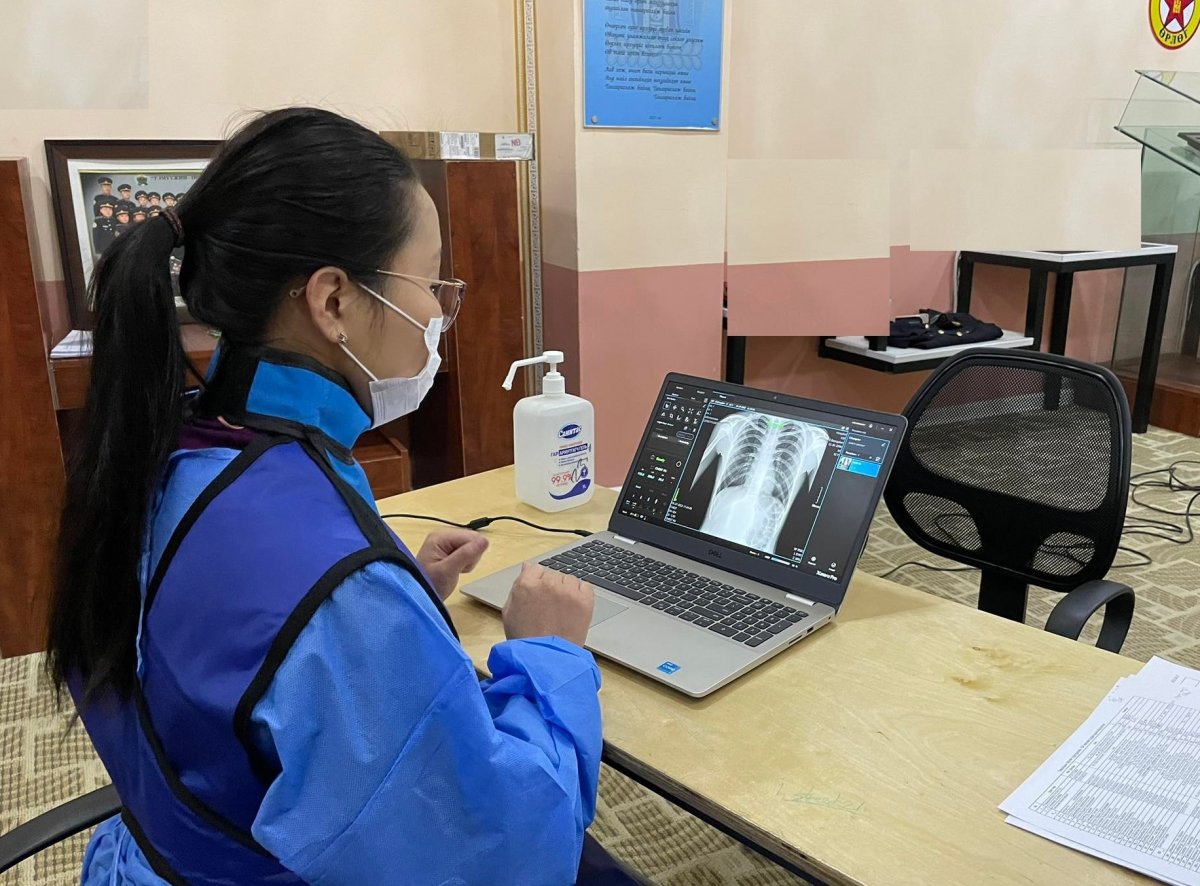 БЗД-ийн ЕБС-ийн 400 гаруй сурагчдыг СҮРЬЕЭГИЙН ЭРТ ИЛРҮҮЛЭГ үзлэгт хамрууллаа