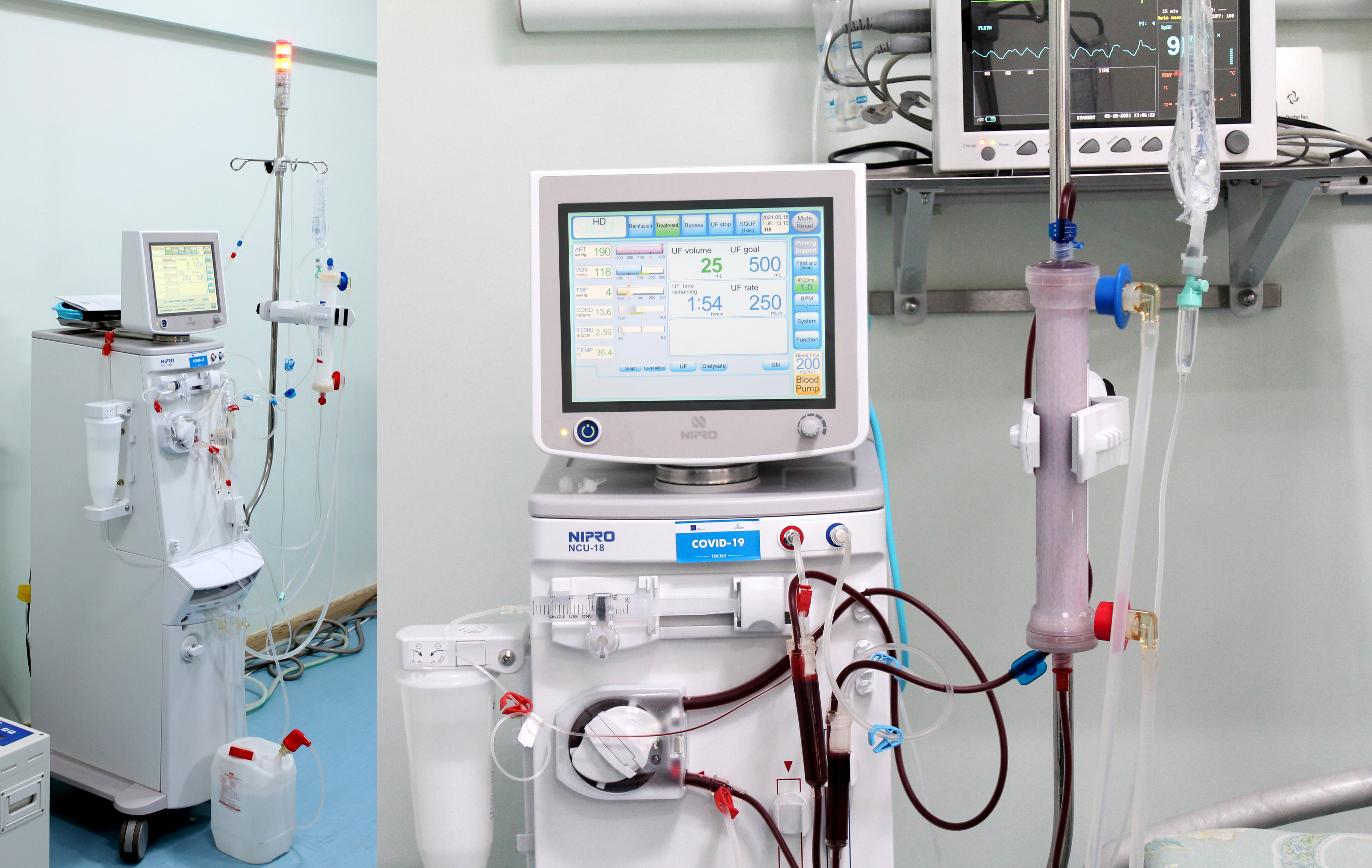 ГССҮТ ГЭМТЭЛ БОЛОН ТҮЛЭГДЭЛТИЙН ГАРАЛТАЙ БӨӨРНИЙ ЦОЧМОГ ДУТАГДЛЫН ҮЕИЙН ГЕМОДИАЛИЗ ЭМЧИЛГЭЭНИЙ NIPRO-NCU 18 АППАРАТ СУУРИЛУУЛЛАА